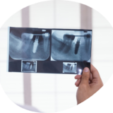 Radiografía Periapical